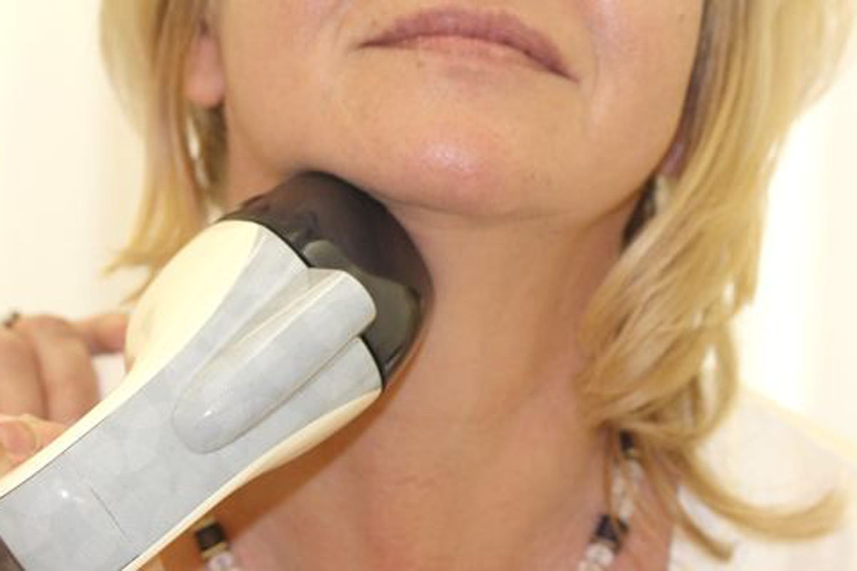 Doppelkinn entfernen mit VelaShape® III bei Dr. Wallentin in Wien